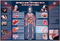 Электрифицированный стенд "Вредные привычки: алкоголизм" - «globural.ru» - Волгодонск